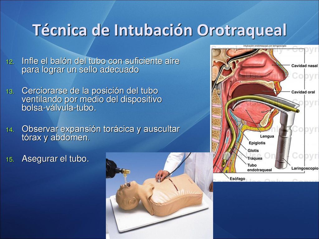 criterios de intubación endotraqueal pdf