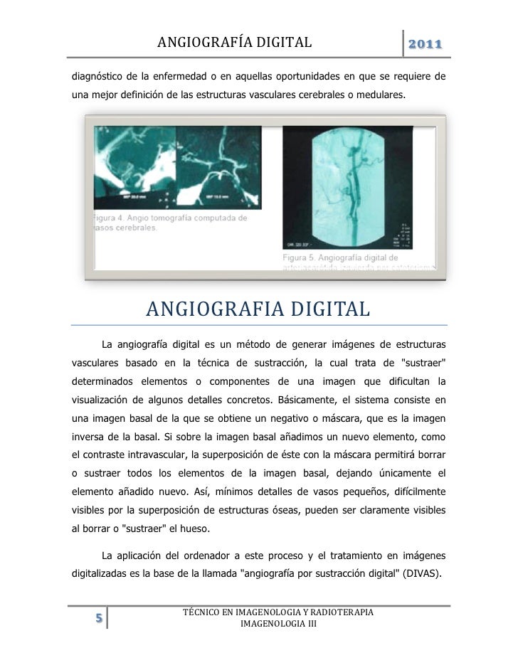 angiografia por sustraccion digital pdf